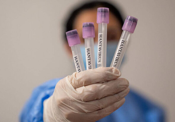 hastanede-ciddi-ihmal-12-saglik-calisani-hantavirus-riski-nedeniyle-karantinaya-alindi-NXsBhv9Z